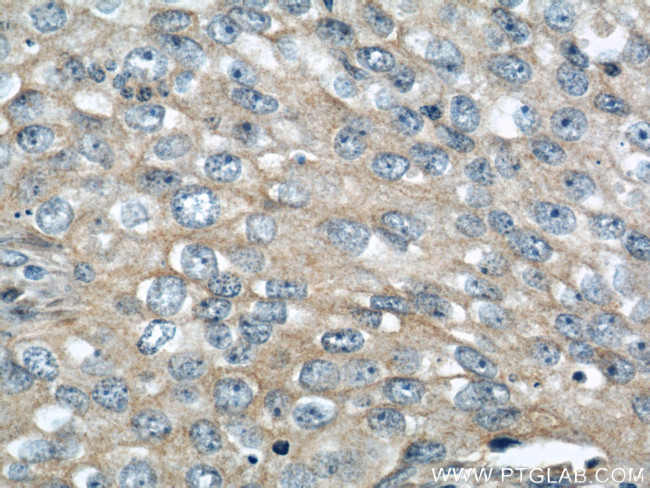 IGFBP3 Antibody in Immunohistochemistry (Paraffin) (IHC (P))