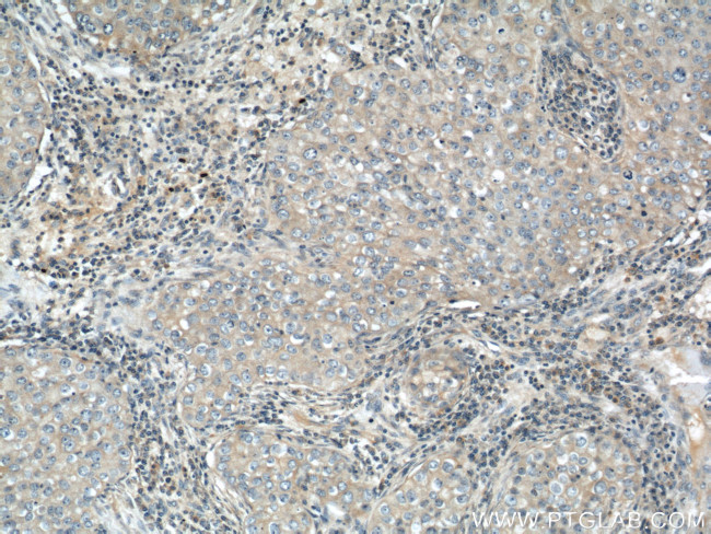 IGFBP3 Antibody in Immunohistochemistry (Paraffin) (IHC (P))