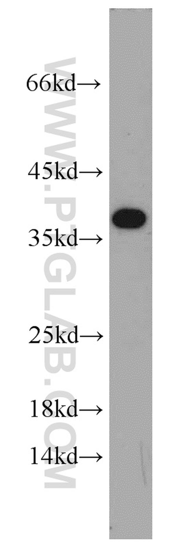 IGFBP3 Antibody in Western Blot (WB)