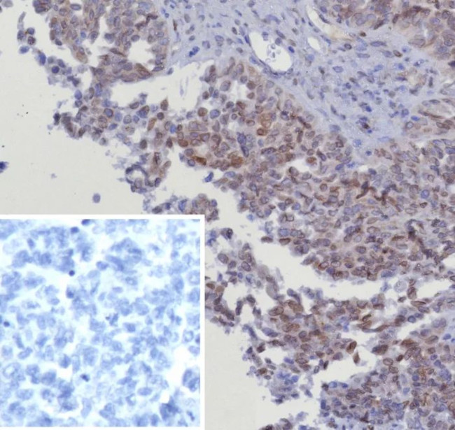 CDK4 Antibody in Immunohistochemistry (Paraffin) (IHC (P))