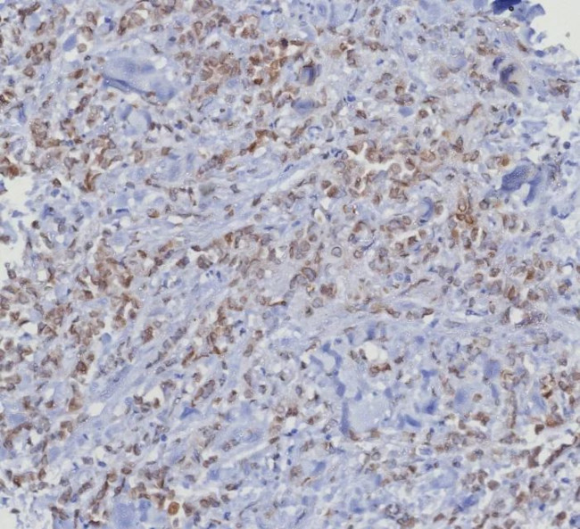 CDK4 Antibody in Immunohistochemistry (Paraffin) (IHC (P))