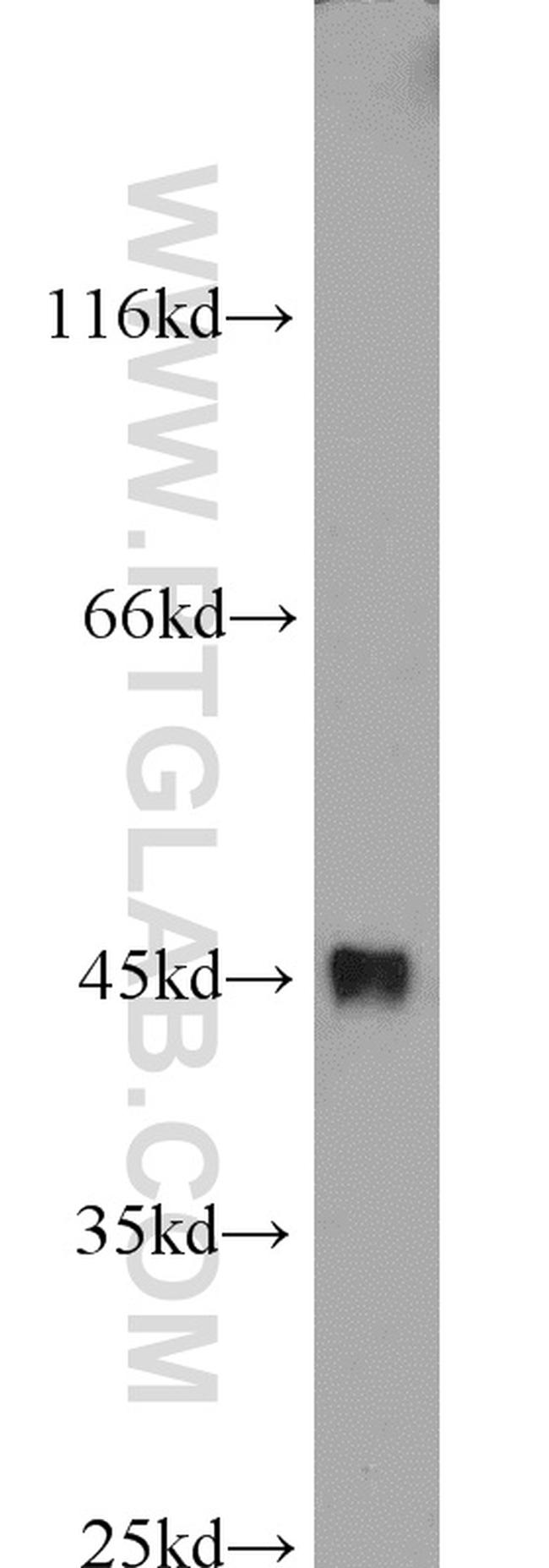 DFF45/DFFA Antibody in Western Blot (WB)