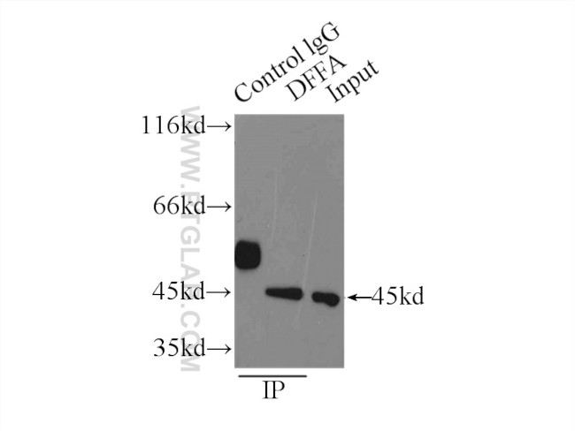 DFF45/DFFA Antibody in Immunoprecipitation (IP)