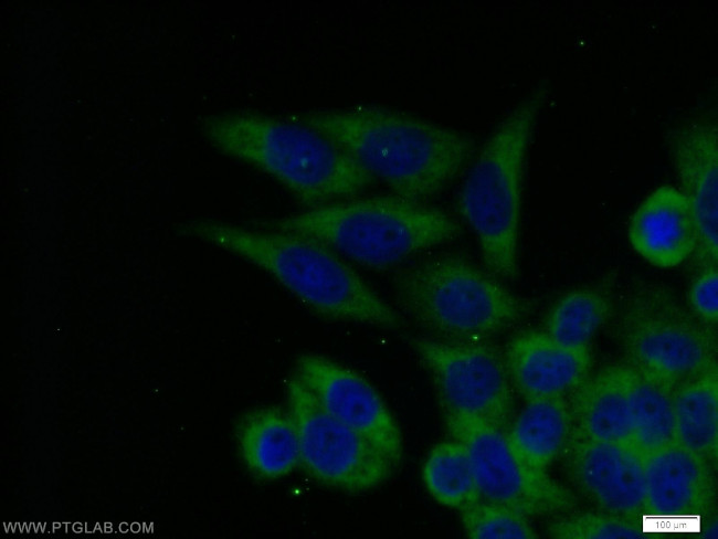 ECD Antibody in Immunocytochemistry (ICC/IF)