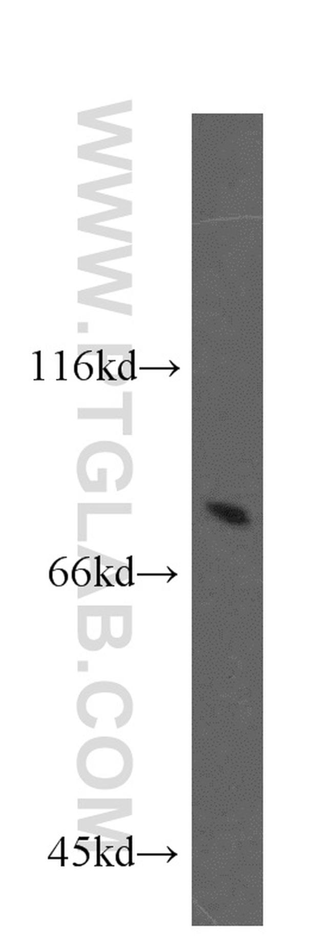 ECD Antibody in Western Blot (WB)