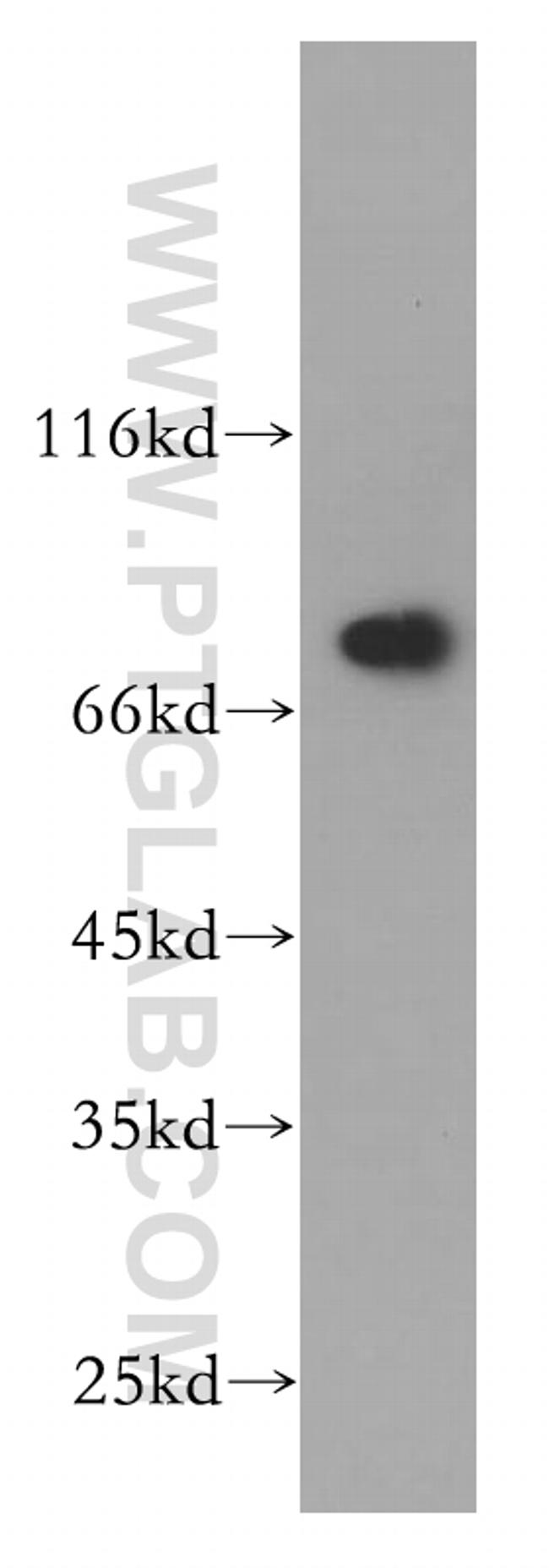 ECD Antibody in Western Blot (WB)