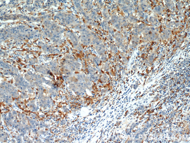 CAPG Antibody in Immunohistochemistry (Paraffin) (IHC (P))