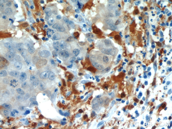 CAPG Antibody in Immunohistochemistry (Paraffin) (IHC (P))