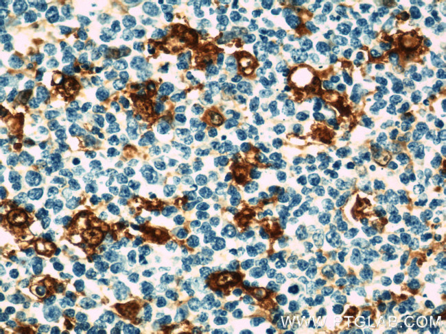 CAPG Antibody in Immunohistochemistry (Paraffin) (IHC (P))