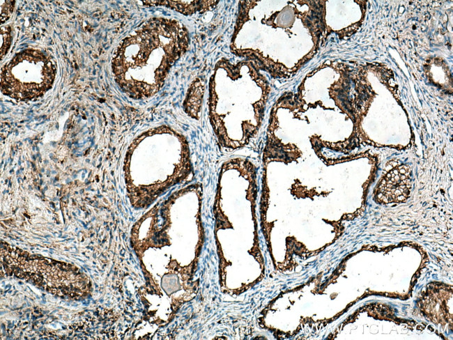 CAPG Antibody in Immunohistochemistry (Paraffin) (IHC (P))