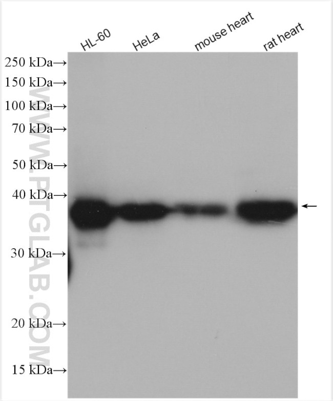 CAPG Antibody in Western Blot (WB)