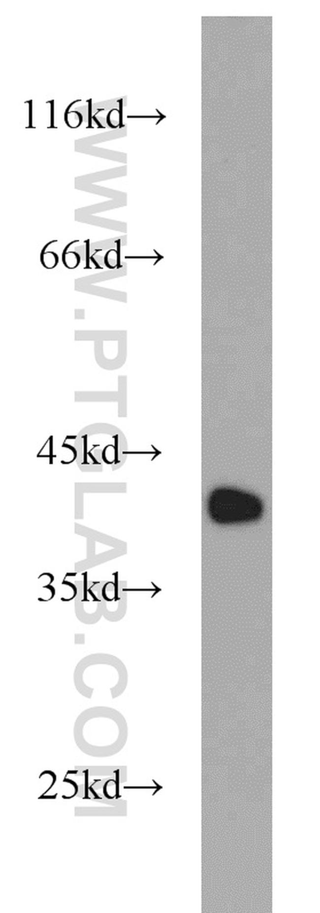 CAPG Antibody in Western Blot (WB)