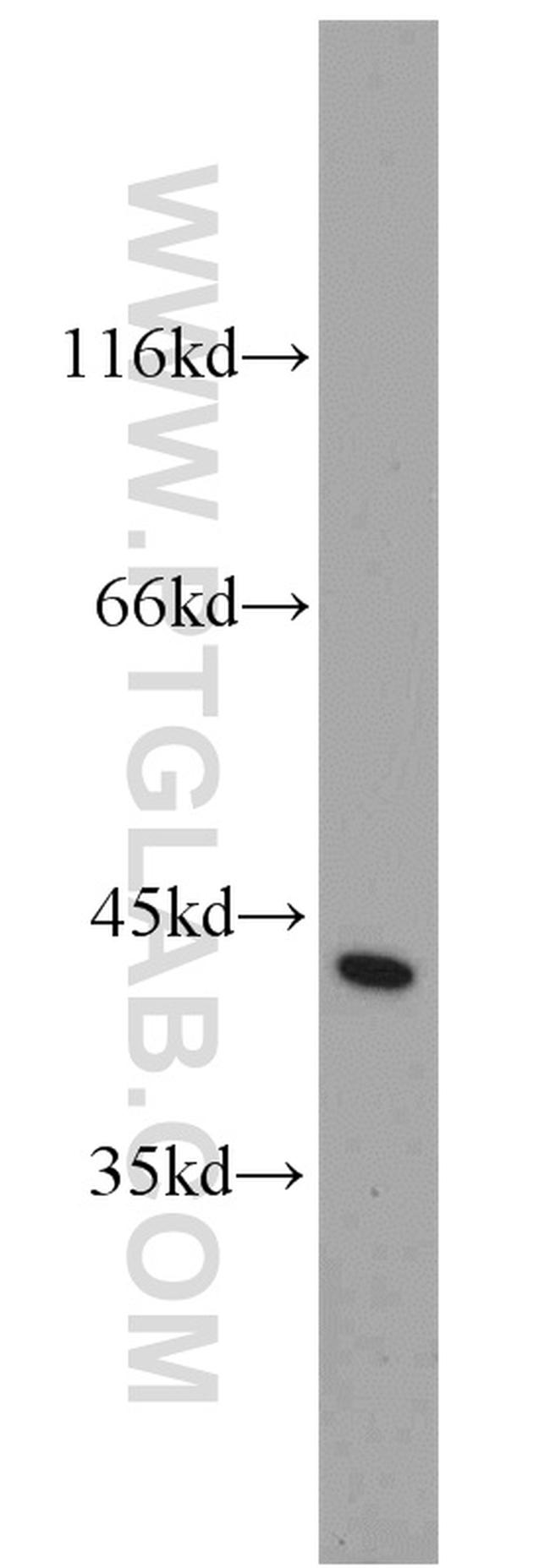 CAPG Antibody in Western Blot (WB)