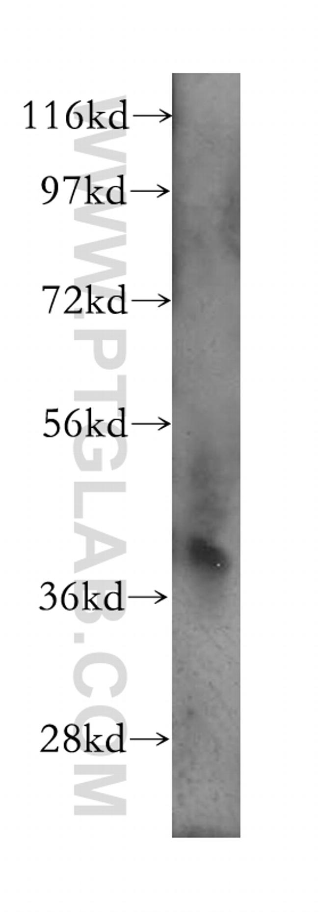 CAPG Antibody in Western Blot (WB)