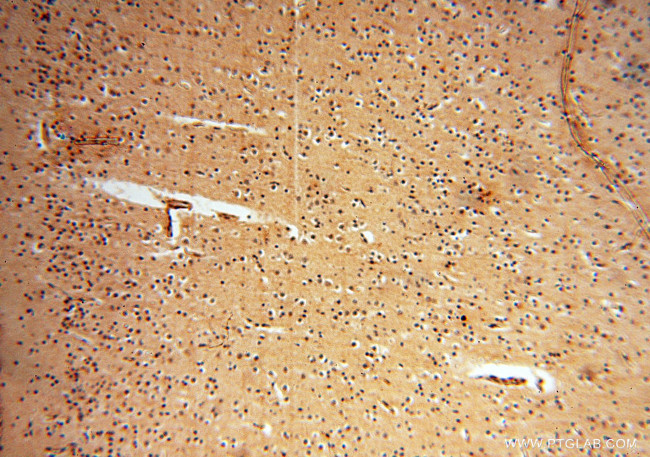 RUVBL2 Antibody in Immunohistochemistry (Paraffin) (IHC (P))