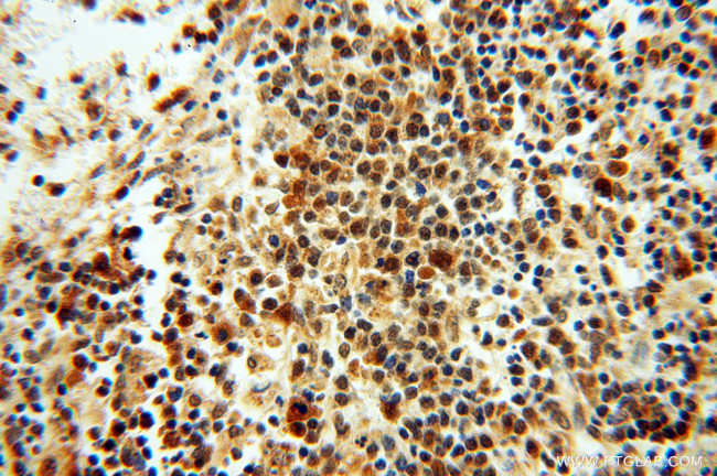 RUVBL2 Antibody in Immunohistochemistry (Paraffin) (IHC (P))