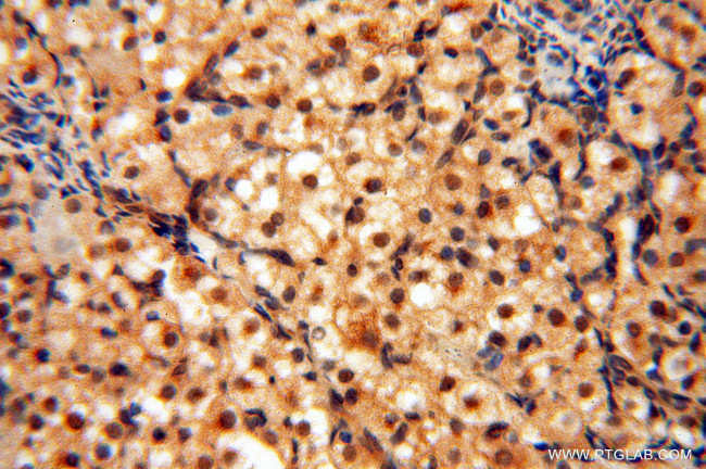 RUVBL2 Antibody in Immunohistochemistry (Paraffin) (IHC (P))