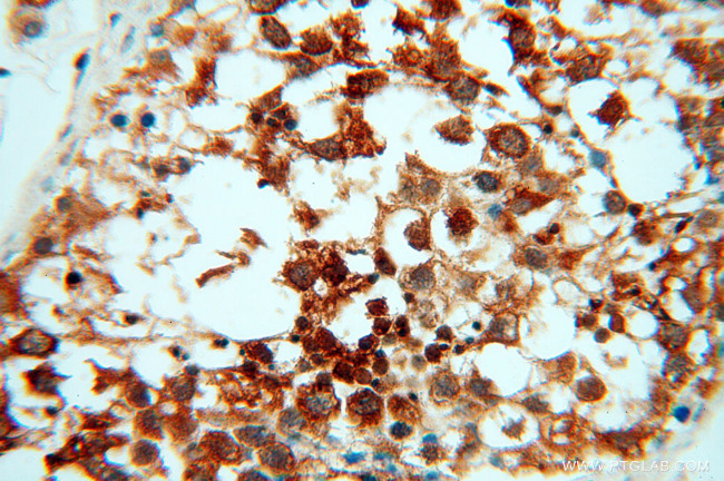 RUVBL2 Antibody in Immunohistochemistry (Paraffin) (IHC (P))