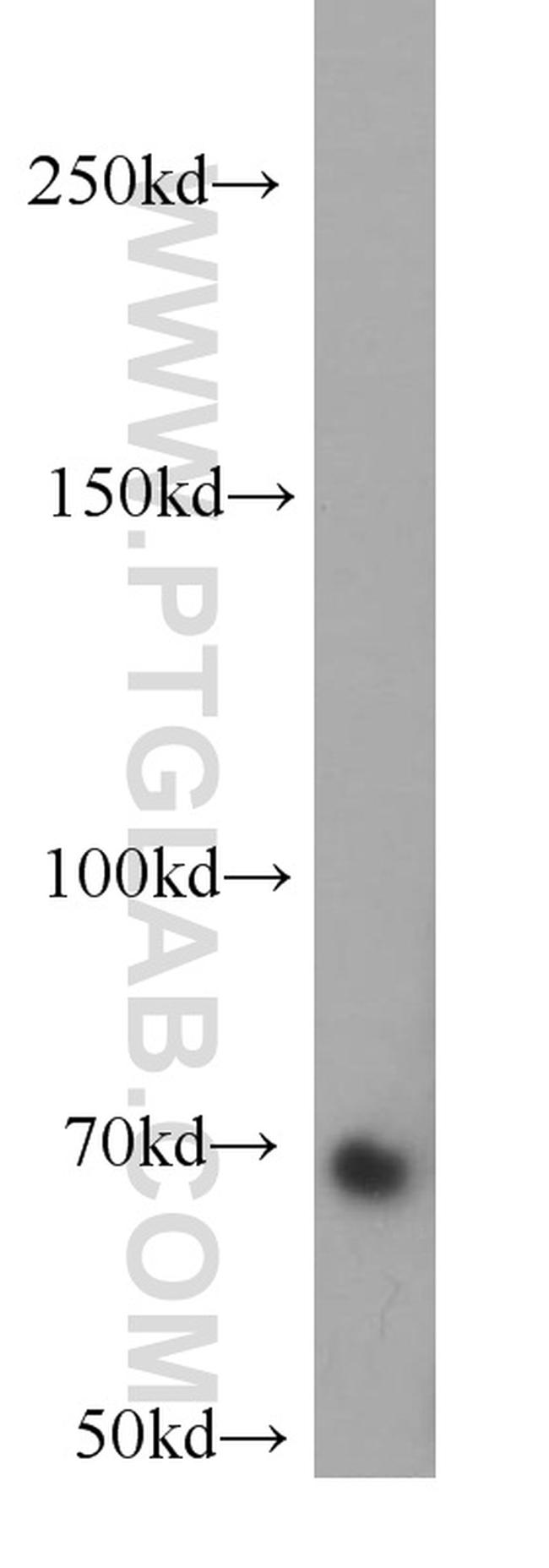 RBM14 Antibody in Western Blot (WB)