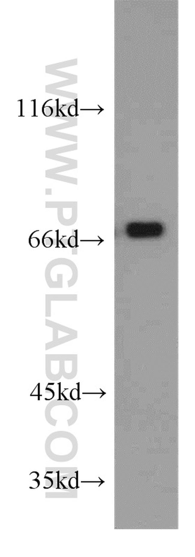 RBM14 Antibody in Western Blot (WB)