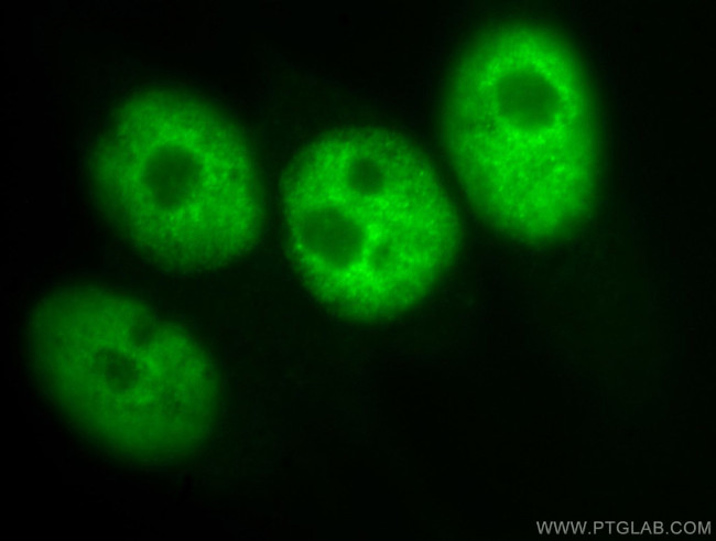 HDAC1 Antibody in Immunocytochemistry (ICC/IF)