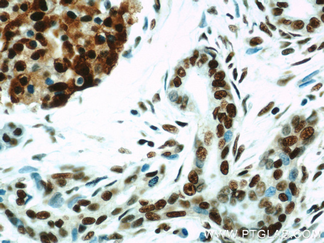 HDAC1 Antibody in Immunohistochemistry (Paraffin) (IHC (P))