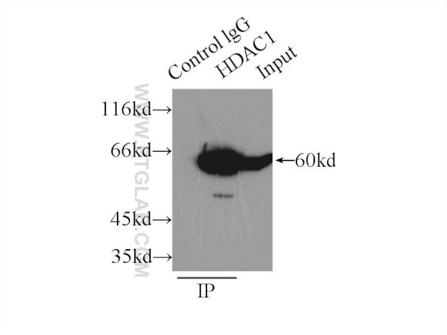 HDAC1 Antibody in Immunoprecipitation (IP)