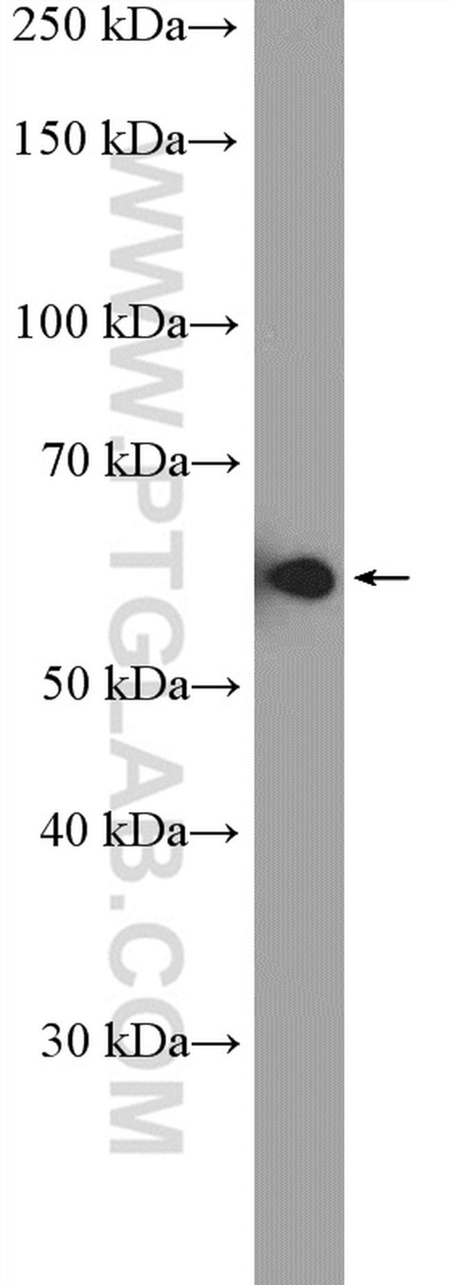 HDAC1 Antibody in Western Blot (WB)