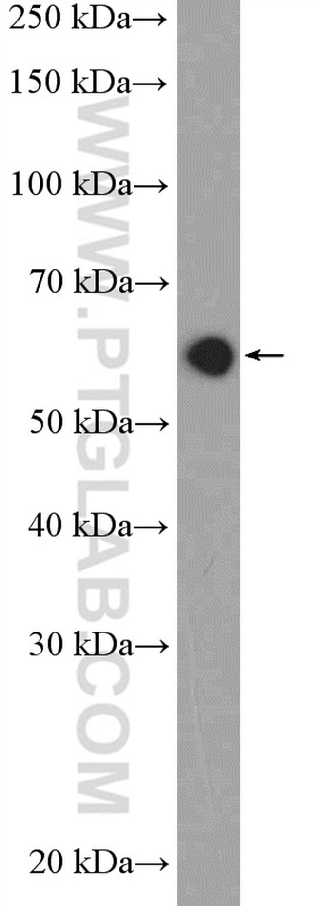 HDAC1 Antibody in Western Blot (WB)