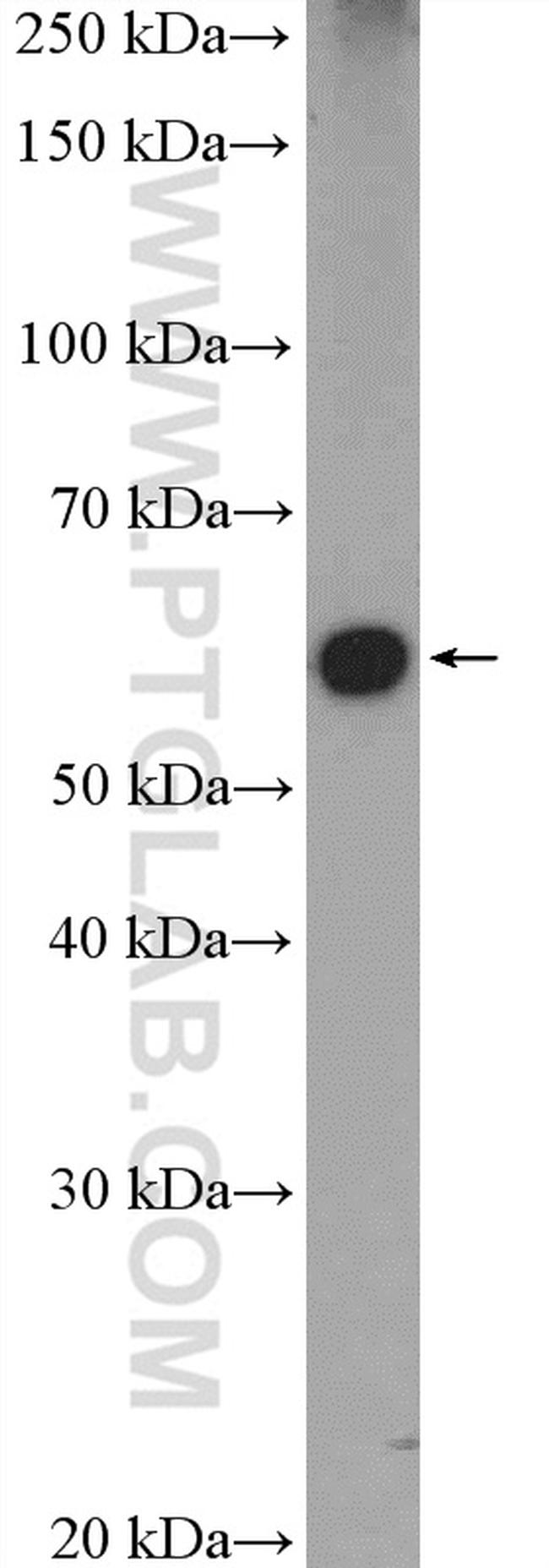 HDAC1 Antibody in Western Blot (WB)