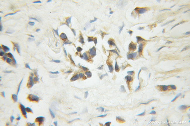 Caspase 6/p18/p11 Antibody in Immunohistochemistry (Paraffin) (IHC (P))