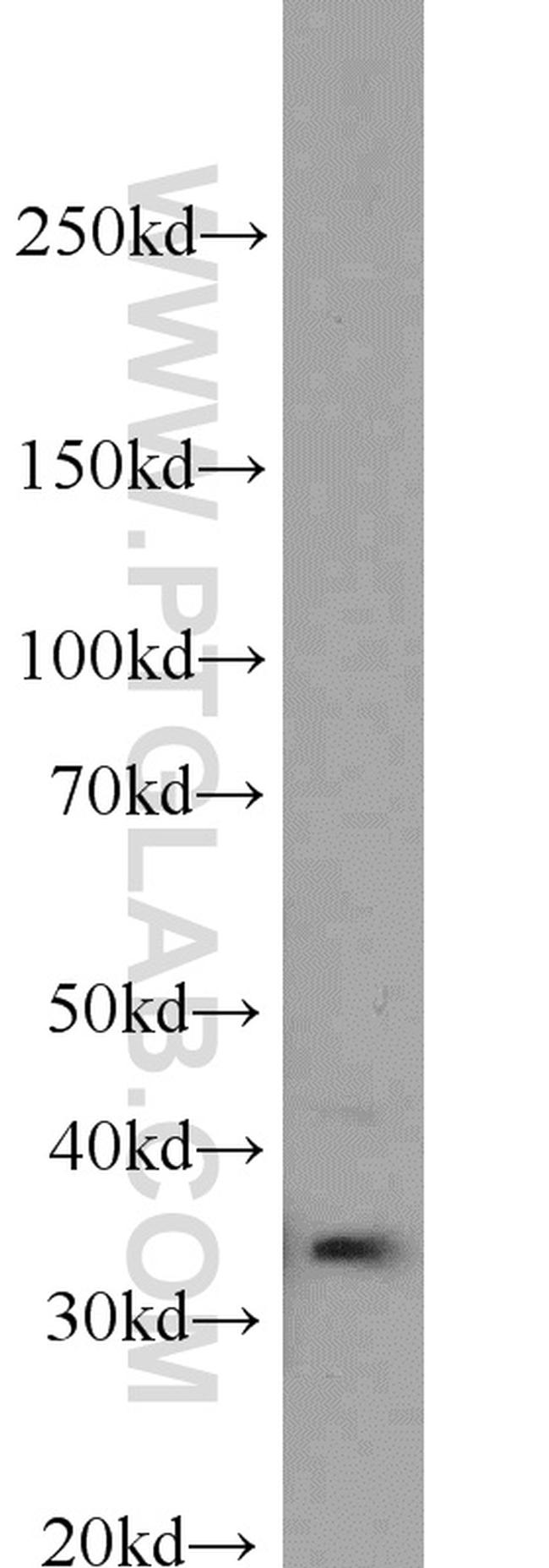 Caspase 6/p18/p11 Antibody in Western Blot (WB)