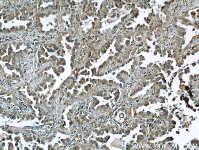 Caspase 6/p18/p11 Antibody in Immunohistochemistry (Paraffin) (IHC (P))