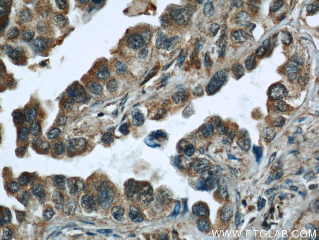 Caspase 6/p18/p11 Antibody in Immunohistochemistry (Paraffin) (IHC (P))