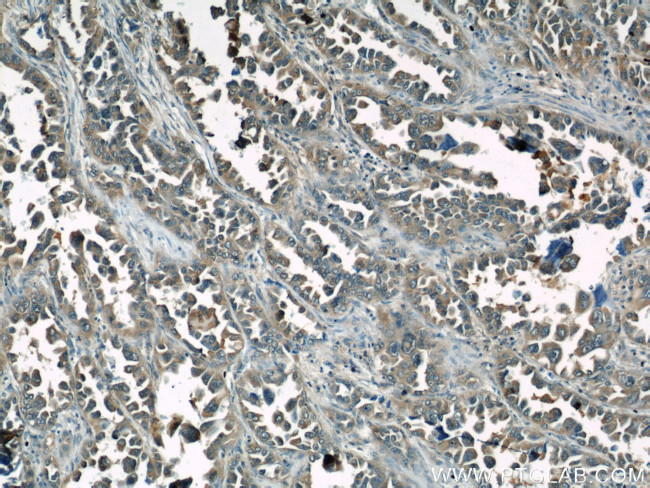 Caspase 6/p18/p11 Antibody in Immunohistochemistry (Paraffin) (IHC (P))