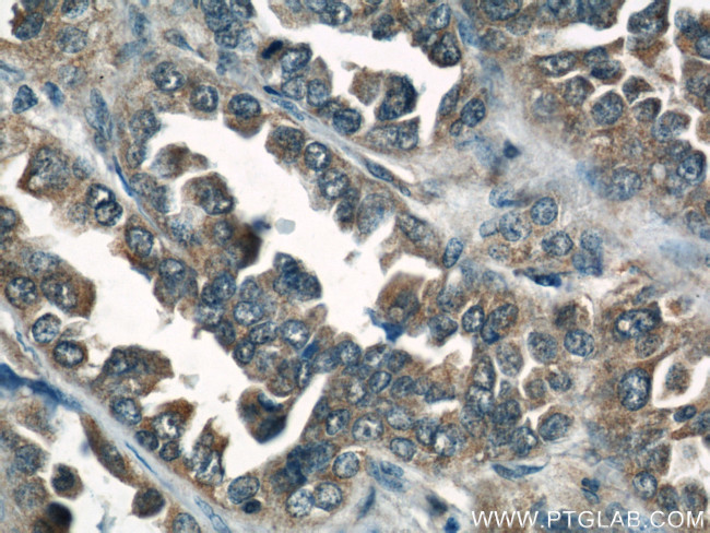 Caspase 6/p18/p11 Antibody in Immunohistochemistry (Paraffin) (IHC (P))