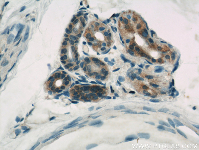 Caspase 6/p18/p11 Antibody in Immunohistochemistry (Paraffin) (IHC (P))