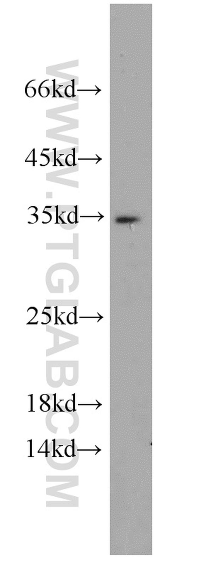 Caspase 6/p18/p11 Antibody in Western Blot (WB)