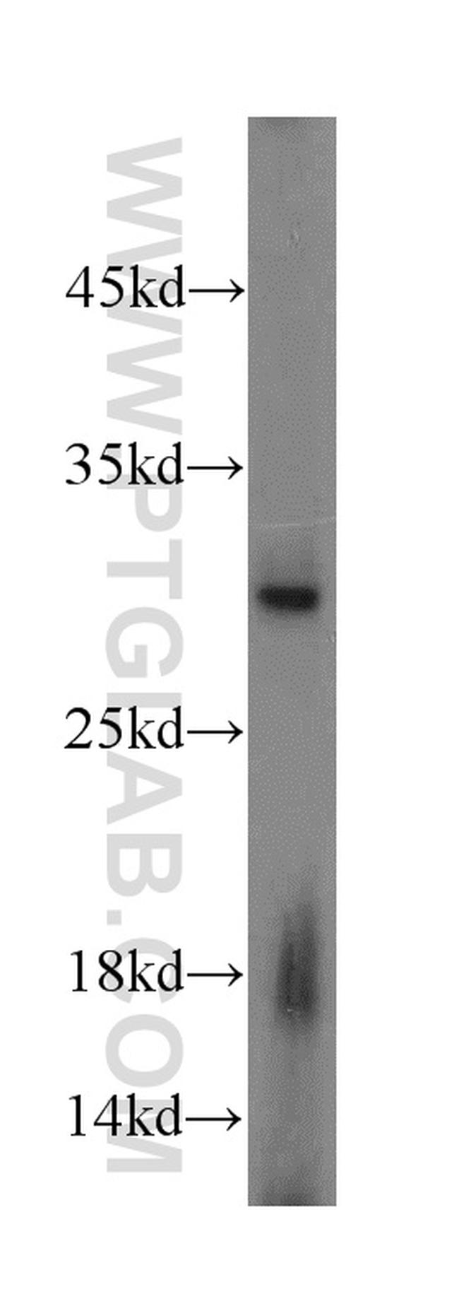 Caspase 6/p18/p11 Antibody in Western Blot (WB)