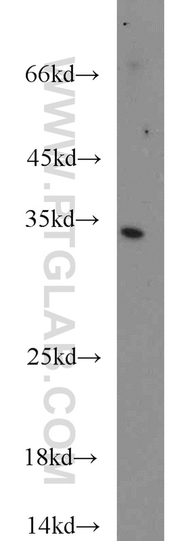 Caspase 6/p18/p11 Antibody in Western Blot (WB)