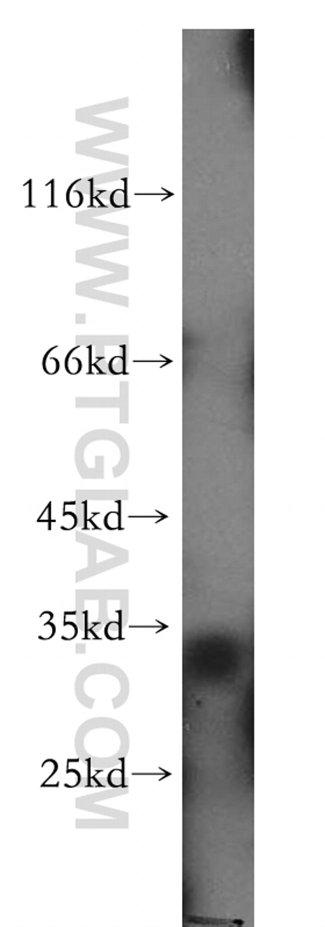 Caspase 6/p18/p11 Antibody in Western Blot (WB)