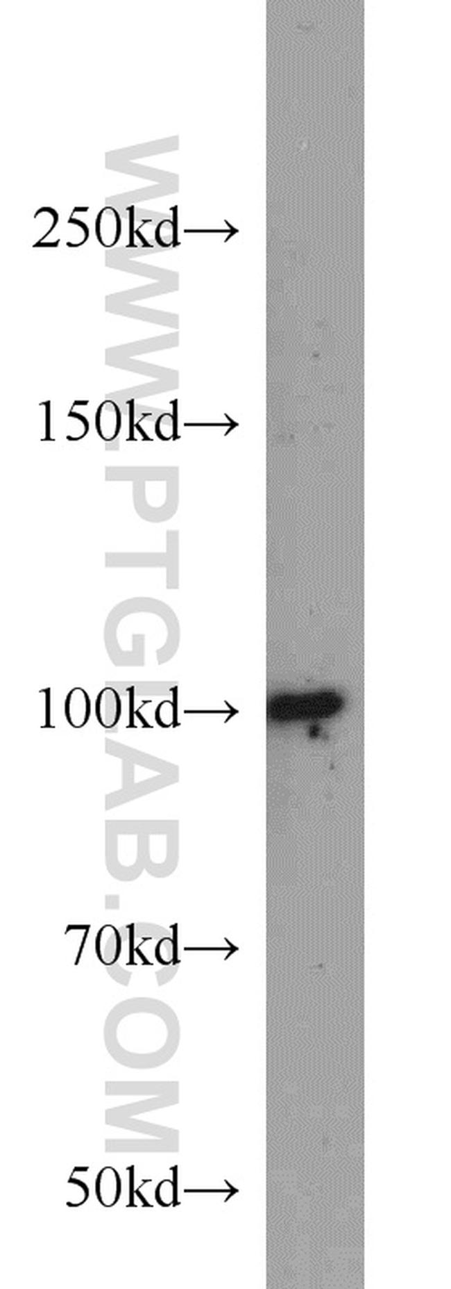 DDX23 Antibody in Western Blot (WB)