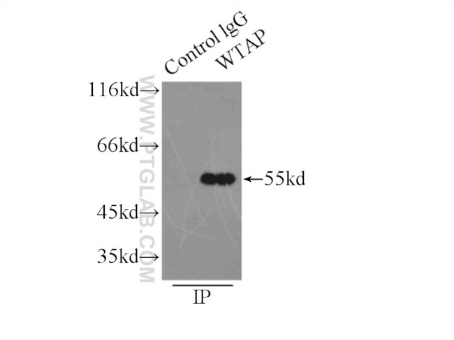 WTAP Antibody in Immunoprecipitation (IP)