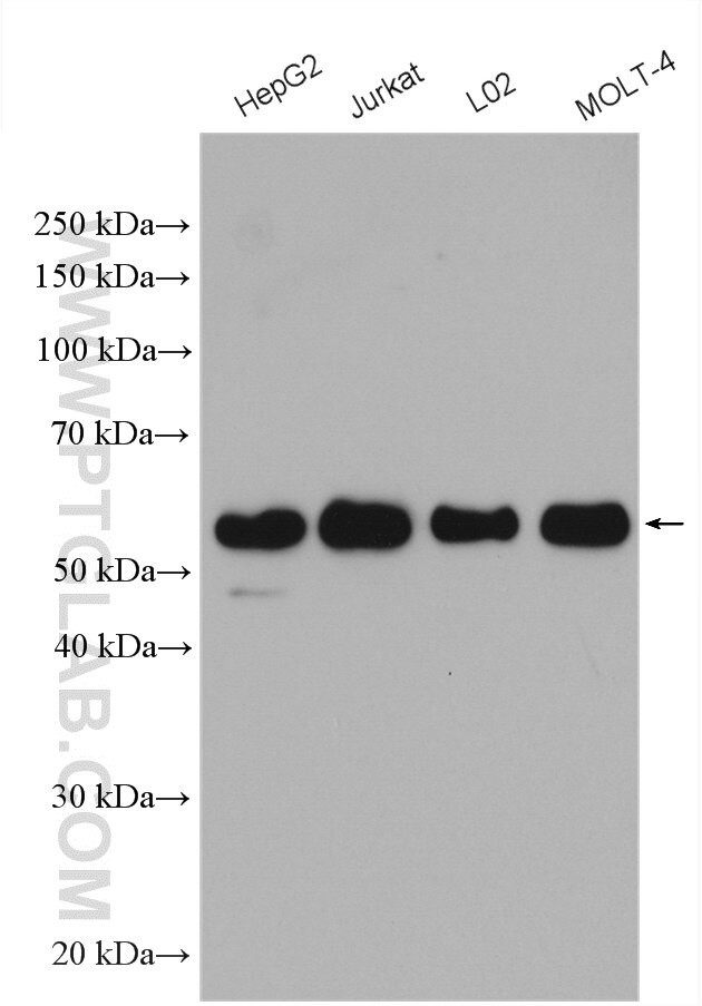 WTAP Antibody in Western Blot (WB)