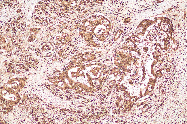 Ubiquitin Antibody in Immunohistochemistry (Paraffin) (IHC (P))