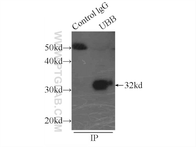 Ubiquitin Antibody in Immunoprecipitation (IP)