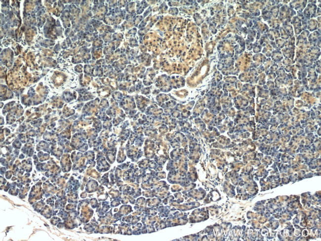 Ubiquitin Antibody in Immunohistochemistry (Paraffin) (IHC (P))