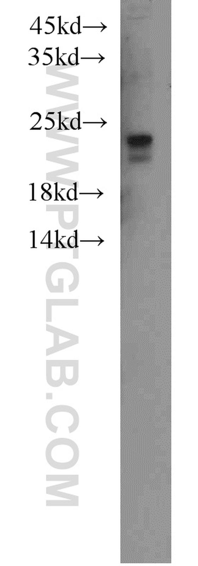 Ubiquitin Antibody in Western Blot (WB)