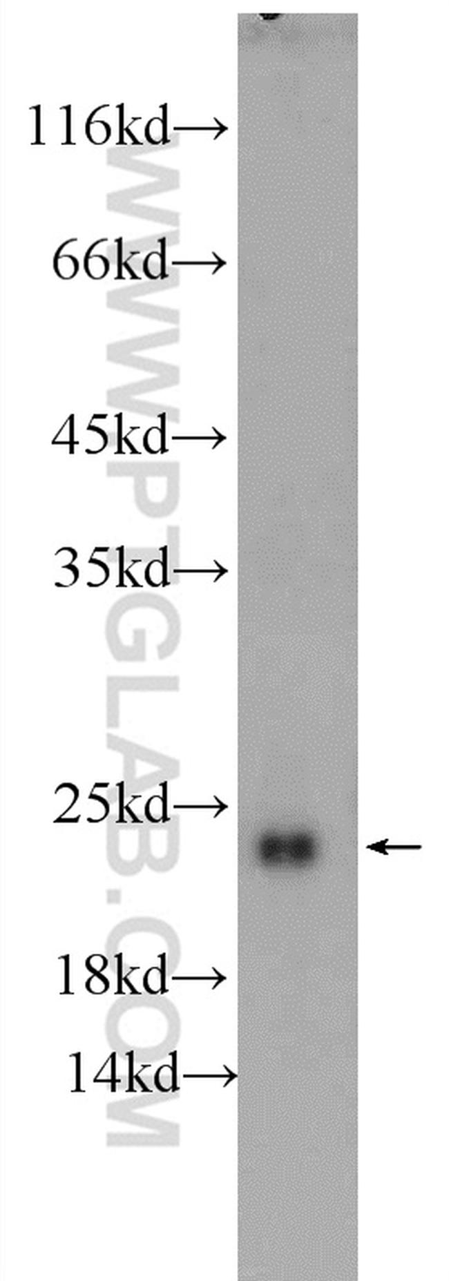 Ubiquitin Antibody in Western Blot (WB)