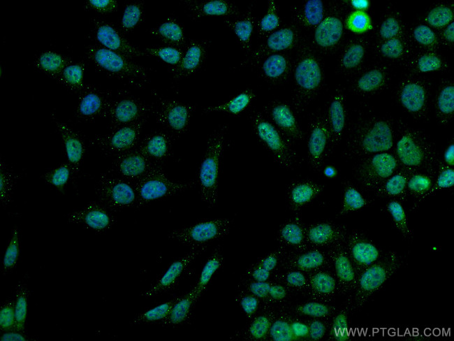 PCNA Antibody in Immunocytochemistry (ICC/IF)